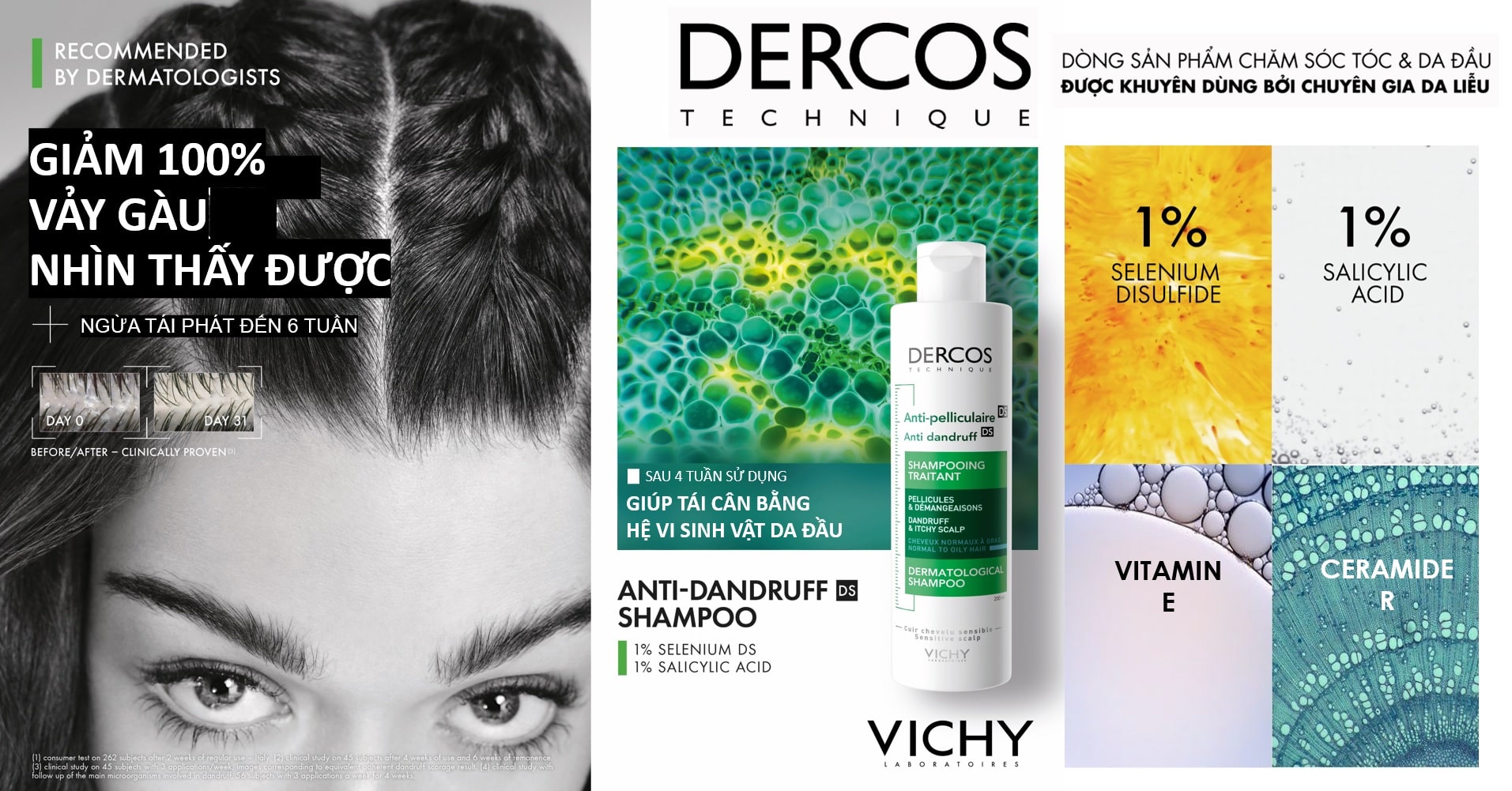 DERCOS ANTI-DANDRUFF DẦU GỘI GIÚP GIẢM GÀU NGAY TỪ LẦN GỘI ĐẦU TIÊN & NGĂN NGỪA GÀU TÁI PHÁT ĐẾN 6 TUẦN